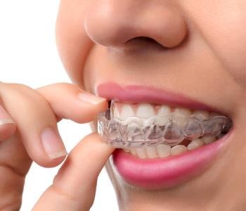 Invisible Braces from Dentist in Oakville ON