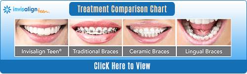 Invisalign Dentists Oakville - Invisalign Treatment Comparison Chart